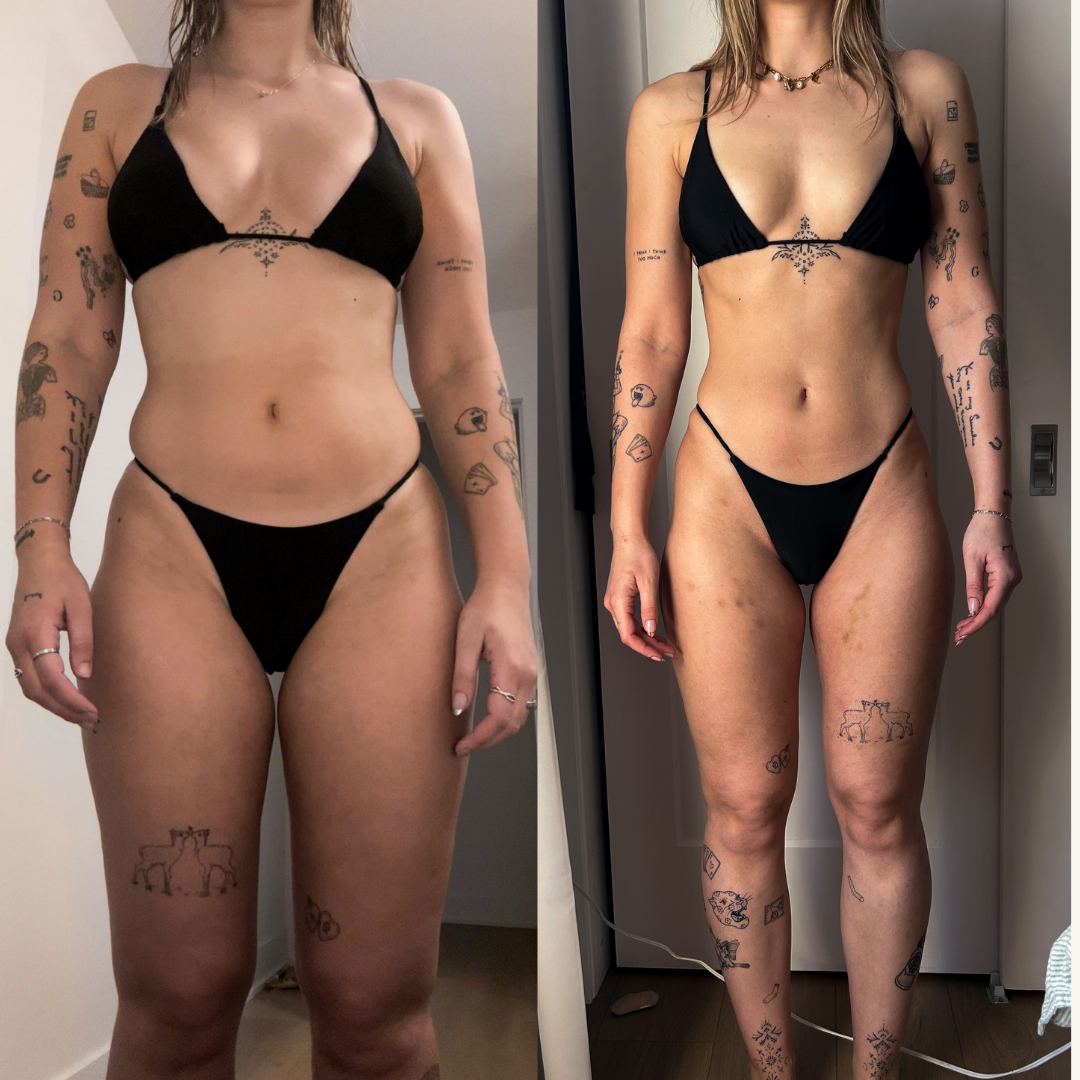 Transformation 1